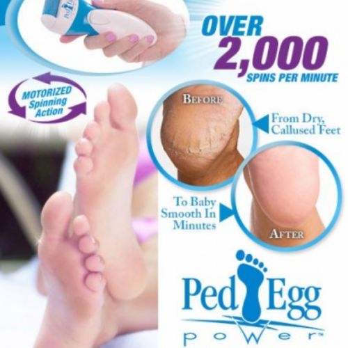 Ped Egg Power As Seen On TV 電気式ペッドエッグ（脚用やすり） (9078-6) / PED EGG POWER